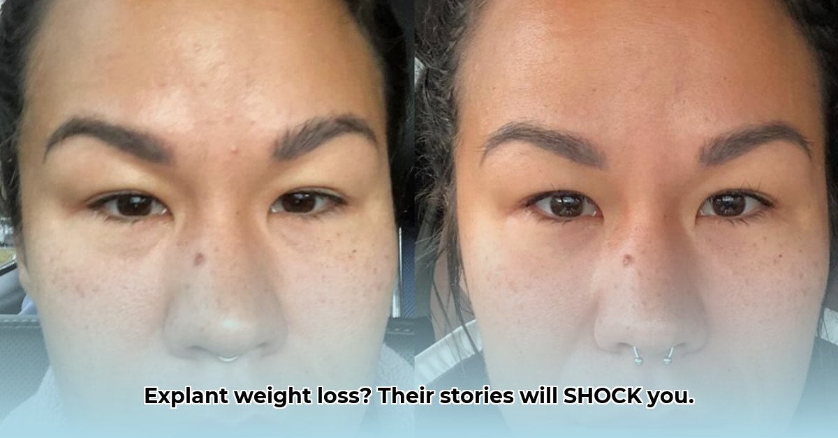 weight-loss-after-explant